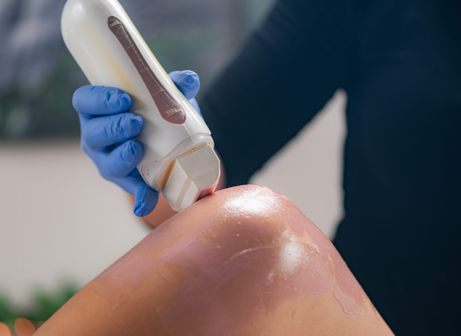 Leg waxing procedure in a top notch beauty center, where smooth results and expert care meet